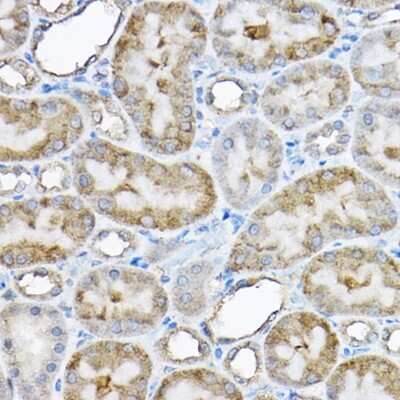 Immunohistochemistry-Paraffin: GRPEL2 Antibody - BSA Free [NBP3-04966]
