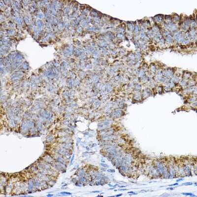 Immunohistochemistry-Paraffin: GRPEL2 Antibody - BSA Free [NBP3-04966]