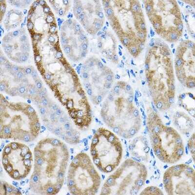 Immunohistochemistry-Paraffin: GRPEL2 Antibody - BSA Free [NBP3-04966]