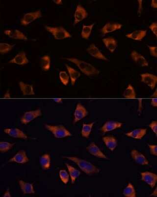 Immunocytochemistry/ Immunofluorescence: GRSF1 Antibody - Azide and BSA Free [NBP2-94114]