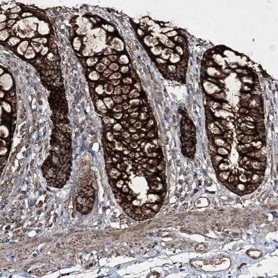 Immunohistochemistry-Paraffin: GRSF1 Antibody [NBP1-89488]