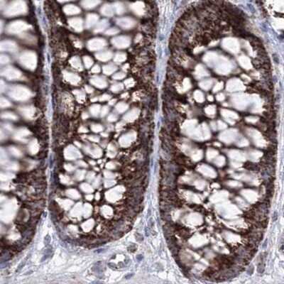Immunohistochemistry-Paraffin: GRSF1 Antibody [NBP2-38341]