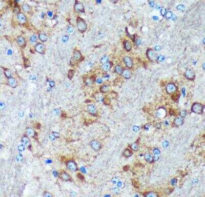 Immunohistochemistry-Paraffin: GRSF1 Antibody - Azide and BSA Free [NBP2-94114]