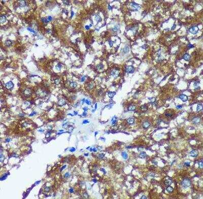 Immunohistochemistry-Paraffin: GRSF1 Antibody - Azide and BSA Free [NBP2-94114]