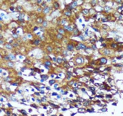 Immunohistochemistry-Paraffin: GRSF1 Antibody - Azide and BSA Free [NBP2-94114]