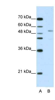 Western Blot: GRSF1 Antibody [NBP1-57315]