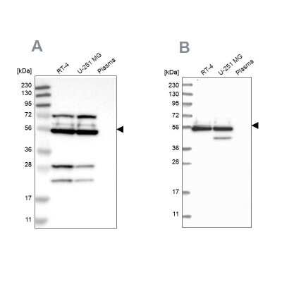Western Blot: GRSF1 Antibody [NBP2-38341]