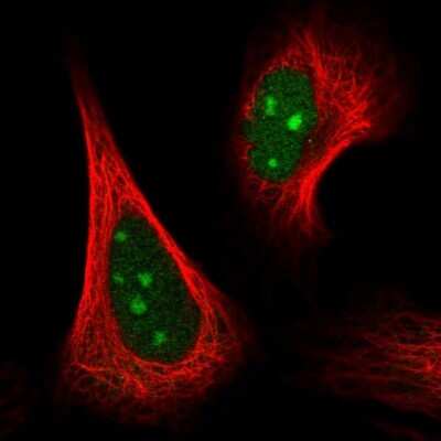 Immunocytochemistry/ Immunofluorescence: GRWD1 Antibody [NBP2-56888]