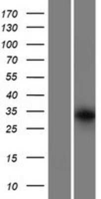 Western Blot: GRXCR1 Overexpression Lysate [NBP2-08337]