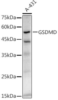 Western Blot: GSDMDC1 Antibody (5U7R7) [NBP3-16070]
