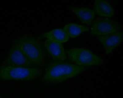 Immunocytochemistry/ Immunofluorescence: GSDMDC1 Antibody [NBP2-80427]