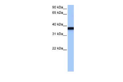 Western Blot: GSG1 Antibody [NBP2-84055]
