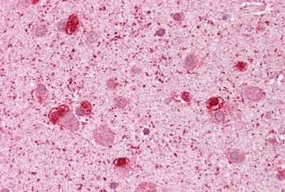 Immunohistochemistry: GSH2 Antibody [NBP2-86661]