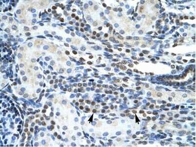 Immunohistochemistry: GSH2 Antibody [NBP2-86661]