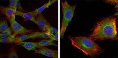 Immunocytochemistry/ Immunofluorescence: GSK-3 beta Antibody (3D10) - Azide and BSA Free [NBP2-80757]