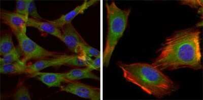 Immunocytochemistry/ Immunofluorescence: GSK-3 beta Antibody (3D10) - BSA Free [NBP1-47470]