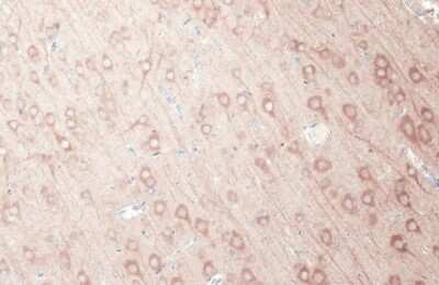 Immunohistochemistry-Paraffin: GSK-3 beta Antibody (GT1619) [NBP3-13691]