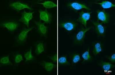Immunocytochemistry/ Immunofluorescence: GSK-3 beta Antibody (GT16711) [NBP3-13679]
