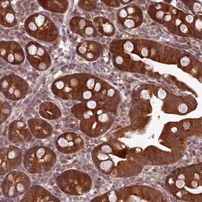 Immunohistochemistry-Paraffin: GSKIP Antibody [NBP2-30680]