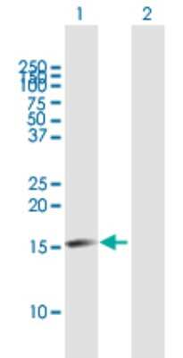 Western Blot: GSKIP Antibody [H00051527-B01P]