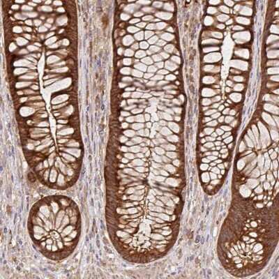 Immunohistochemistry-Paraffin: GSPT1 Antibody [NBP2-47442]