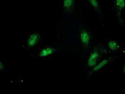 Immunocytochemistry/ Immunofluorescence: GSPT2 Antibody (OTI2G9) [NBP2-00873]