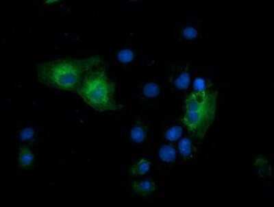 Immunocytochemistry/ Immunofluorescence: GSPT2 Antibody (OTI2G9) - Azide and BSA Free [NBP2-71768]