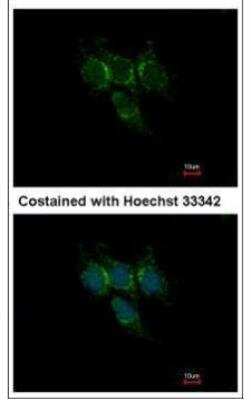 Immunocytochemistry/ Immunofluorescence: GSTA1 Antibody [NBP1-32233]
