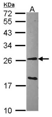 Western Blot: GSTA1 Antibody [NBP1-32233]