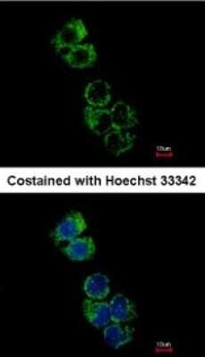 Immunocytochemistry/ Immunofluorescence: GSTA2 Antibody [NBP1-32157]