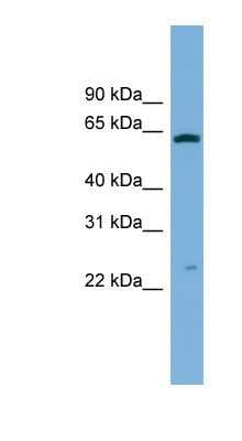 Western Blot: GSTA3 Antibody [NBP1-53196]