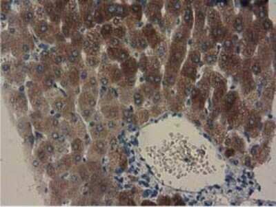 Immunohistochemistry: GSTA4 Antibody (OTI3F5) - Azide and BSA Free [NBP2-70856]