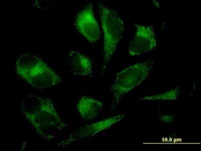 Immunocytochemistry/ Immunofluorescence: GSTM2 Antibody (1E10) [H00002946-M03]
