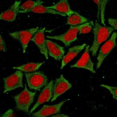Immunocytochemistry/ Immunofluorescence: GSTM2 Antibody (CPTC-GSTMu2-2) [NBP3-07346]