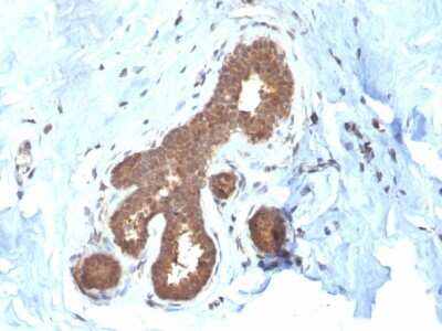 Immunohistochemistry-Paraffin: GSTM2 Antibody (CPTC-GSTMu2-2) [NBP3-07346]