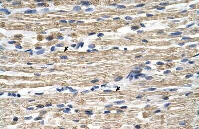 Immunohistochemistry-Paraffin: GSTM2 Antibody [NBP1-55103]