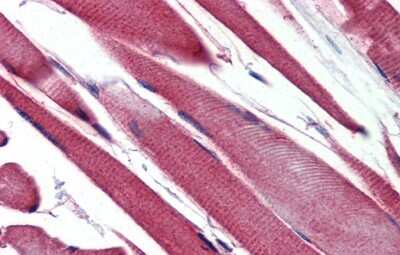 Immunohistochemistry-Paraffin: GSTM2 Antibody [NBP1-55103]