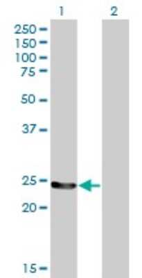Western Blot: GSTM4 Antibody (4B4) [H00002948-M01]