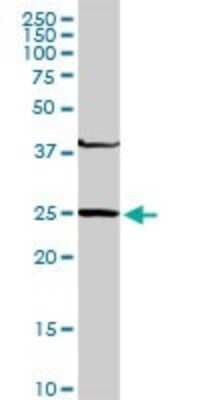 Western Blot: GSTM4 Antibody [H00002948-D01P]