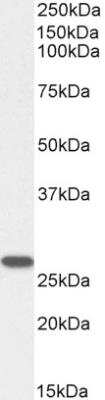 Western Blot: GSTM4 Antibody [NBP2-75088]
