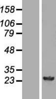 Western Blot: GSTM4 Overexpression Lysate [NBL1-11374]
