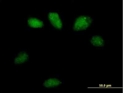 Immunocytochemistry/ Immunofluorescence: GSTO2 Antibody [H00119391-B01P]