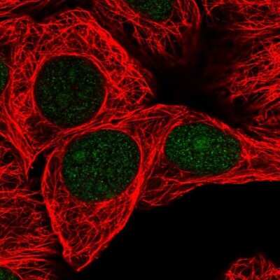Immunocytochemistry/ Immunofluorescence: GSTO2 Antibody [NBP2-14075]