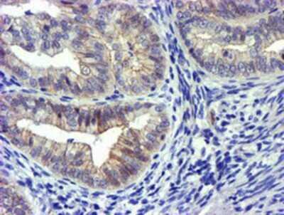 Immunohistochemistry: GSTO2 Antibody (OTI2A12) - Azide and BSA Free [NBP2-72371]