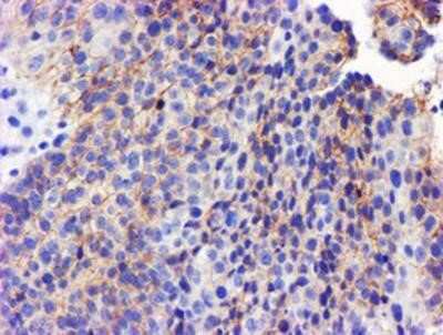 Immunohistochemistry-Paraffin: GSTO2 Antibody (OTI2A12) [NBP2-01626]