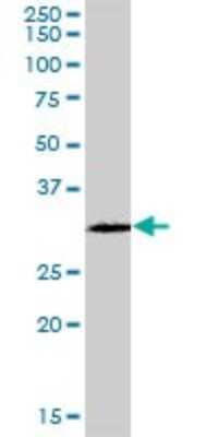Western Blot: GSTO2 Antibody [H00119391-B01P]