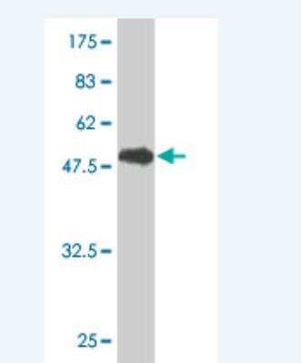 Western Blot: GSTT1 Antibody (2E10-1B2) [H00002952-M01]