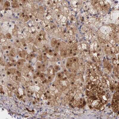 Immunohistochemistry-Paraffin: GSTT2B Antibody [NBP1-86186]
