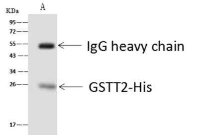 Immunoprecipitation: GSTT2B Antibody [NBP3-06612]