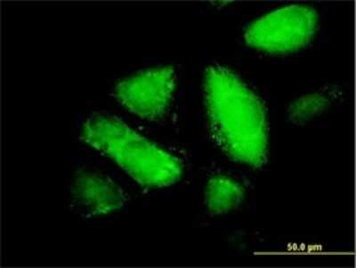Immunocytochemistry/ Immunofluorescence: GSTZ1 Antibody (1G12) [H00002954-M01]